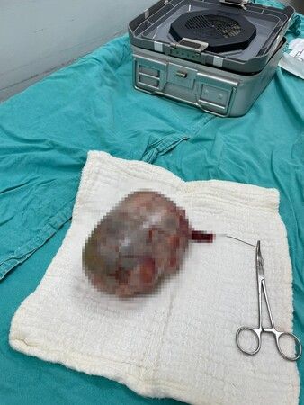 Testis222