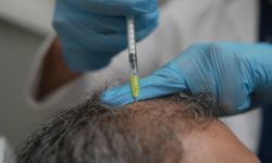 Dökülen saçlar vücudun bir alarmı olabilir