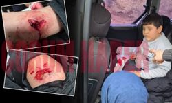12 yaşındaki çocuk kabusu yaşadı! 4 köpeğin saldırısına uğradı
