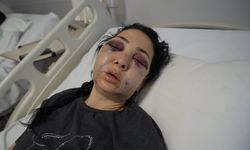 Kafede dehşet anları: Öldüresiye dövdüler