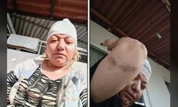 Kafasına şişeyle vurdular, öldü sanıp ormana bıraktılar!