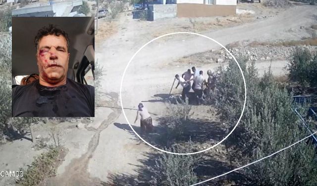 Kafası taşla ezilmek istenen baygın kocasını saldırganlara taş atarak kurtardı