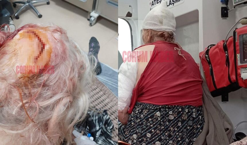 Çorum'da yaşlı kadına köpekler saldırdı