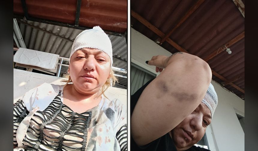 Kafasına şişeyle vurdular, öldü sanıp ormana bıraktılar!